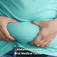 Abdominoplastia: soluția ideală pentru excesul de piele post-slăbire