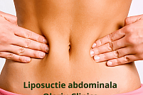 Introducere în liposucția abdominală la Clinica Olariu